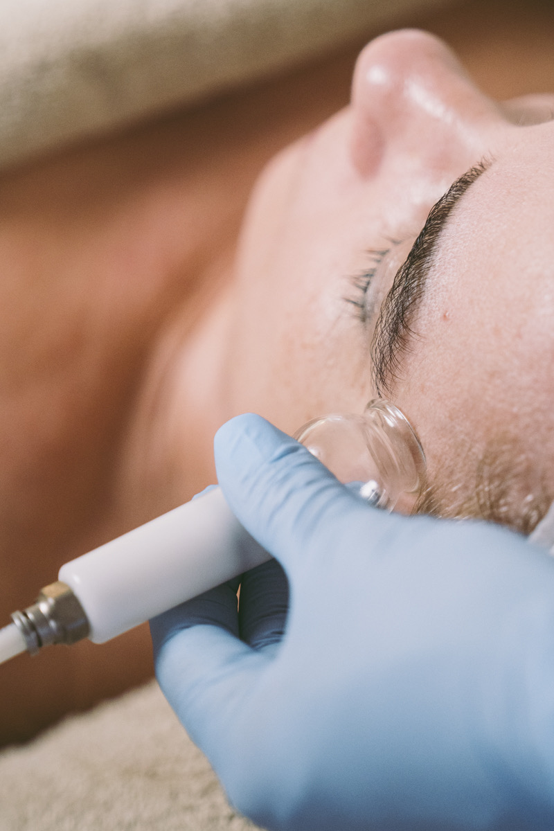 Tratamiento LPG facial en BELSA Estetic
